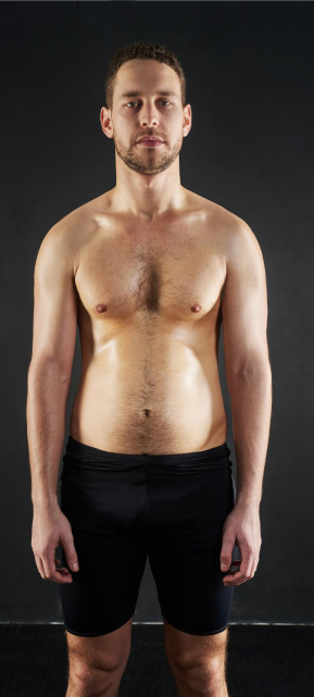 قبل و بعد | دکتر یگانه کیان