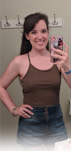 قبل و بعد | دکتر یگانه کیان